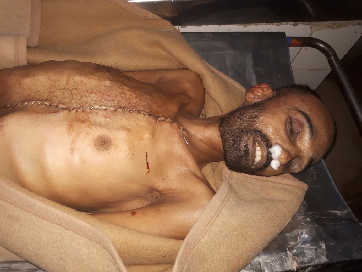 EXPOSED: Pakistan Army Doing Organ Harvesting after Enforced Disappearance of Ethnic Baloch, Pashtuns and Muhajirs
