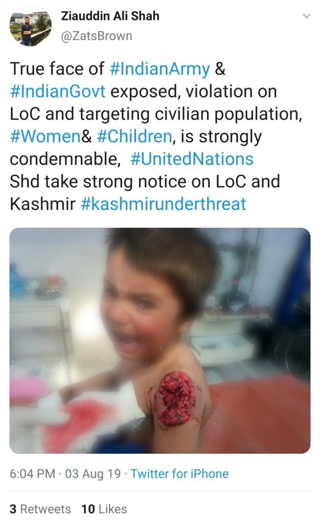 Pakistan Economy is in Shambles. Trolls are paid for Propaganda. One such Troll on Twitter sharing the picture of a boy injured with Artillery Shrapnel to in Fake Propaganda