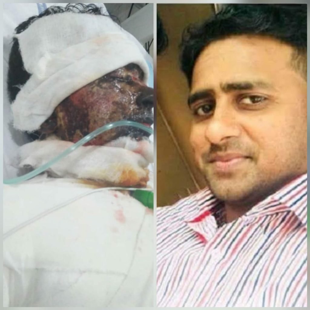 15-September 2018, A Christian manager of a local hospital in Lahore was killed after being targeted in an acid attack
