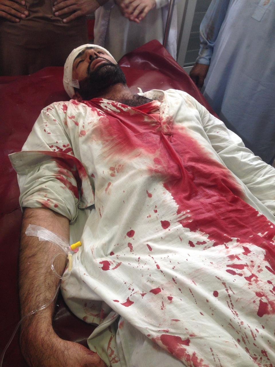 One of the Injured Doctors in Pakistan's Khyber Police Baton charge went to Coma.